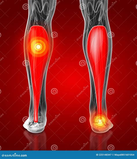 3d Illustration Of The Soleus Muscles Anatomical Position On Xray Body
