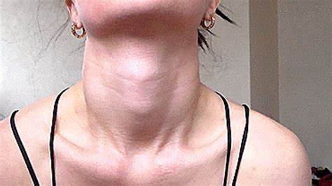 Protruding Adam S Apple Miss Clip Order Miss Love Clips4sale