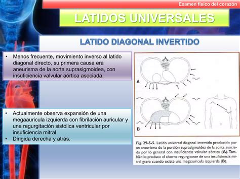 Examen F Sico Del Coraz N Ppt Descarga Gratuita