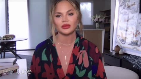 Chrissy Teigen Poses Nude As She Bravely Shows Off Scarred Figure After