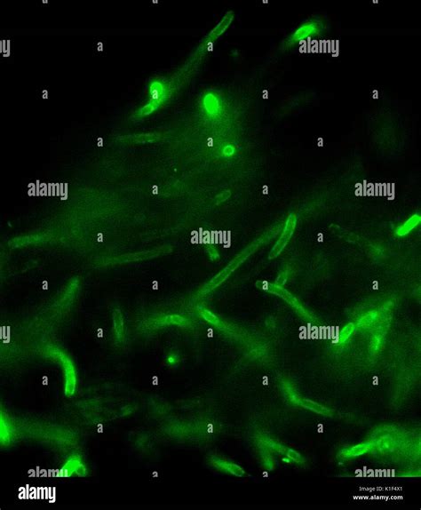 B Anthracis Direct Fluorescent Antibody Dfa Cell Wall Stain B Anthracis Direct Fluorescent