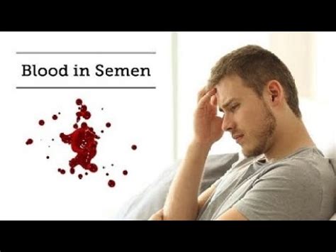 All You Need To Know About Hematospermia And Its Permanent Cure Youtube