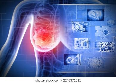 Breast Cancer Female Breast Anatomy D Stock Illustration