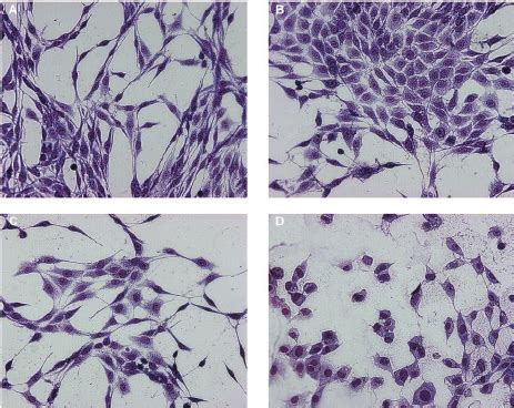 Effect Of Fraction IO4 On Morphology Of Rat Glioma C6 Glioma Cells