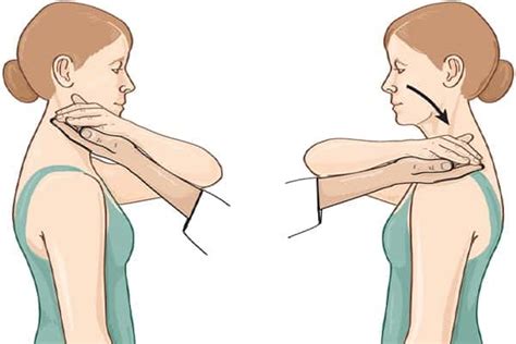 Examen clinique de l épaule Institut Épaule Jouvenet Bilan orthopédique