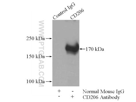 Cd206 Monoclonal Antibody 2a6a10 60143 1 Ig