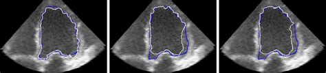 Comparison Of The PBLS Left GAC Middle And GAC ML Right Results