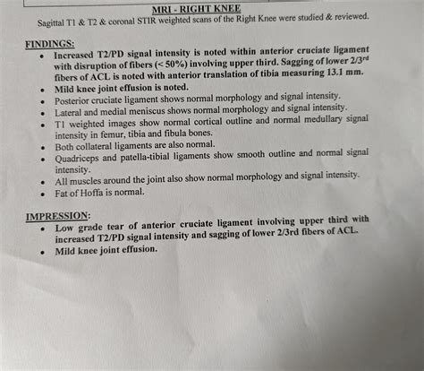 My MRI report : r/ACL