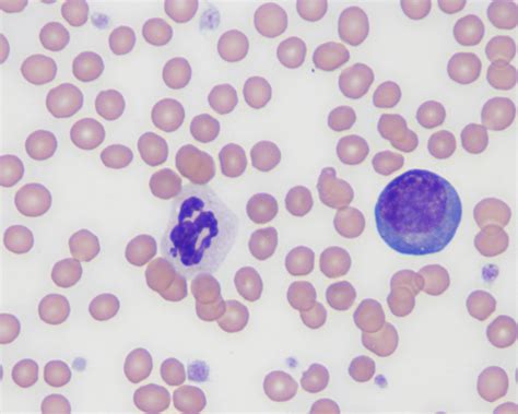 Feline Blood Eclinpath