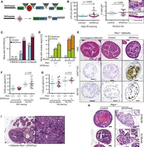 Spop Mutation Drives Prostate Tumorigenesis In Vivo Through Coordinate