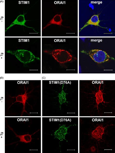 STIM1 Forms Puncta Upon Thapsigargin Induced ER Depletion In Cortical