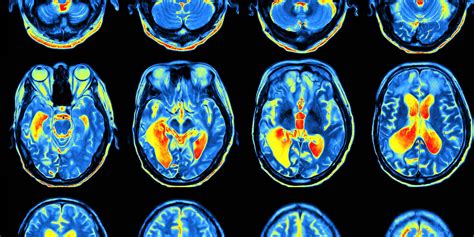 Reality Testing And Learning To Change Our Opinions The Emotional