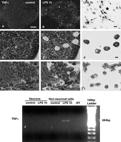 Detection Of Tnf Mrna In Rat Drg By In Situ Hybridization And In