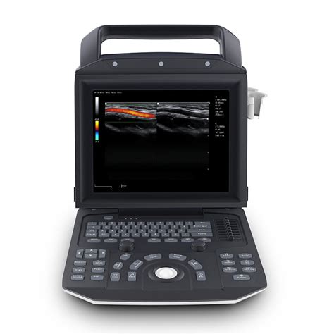 Portable Full Digital Color Doppler Ultrasound System Medical Scanner