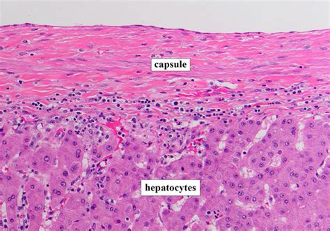 Normal Liver Histology 101 | AASLD