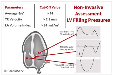 Specific Echo Parameters That Indicate Elevated Lap Cardioserv