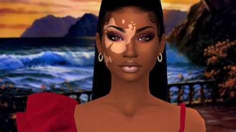 Vitiligo Sims 4 Mod