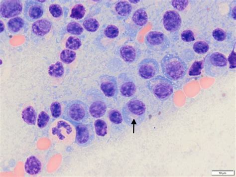 Plasma Cell Tumours In Dogs Multiple Myeloma Veterinary Practice