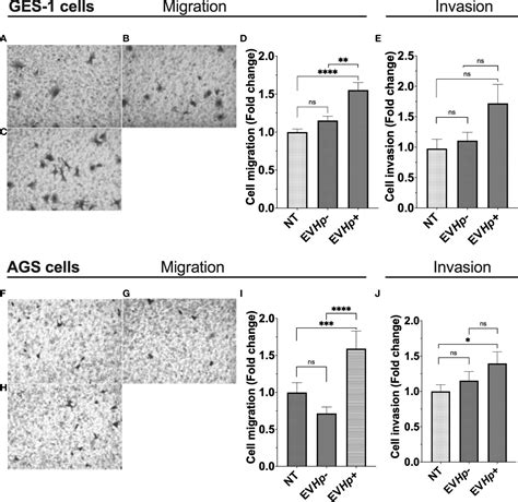 Frontiers Extracellular Vesicles From Gastric Epithelial Ges 1 Cells