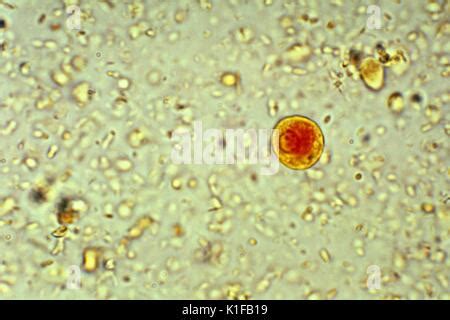 Esta Microfotograf A Muestra Un Quiste De Un Par Sito Entamoeba