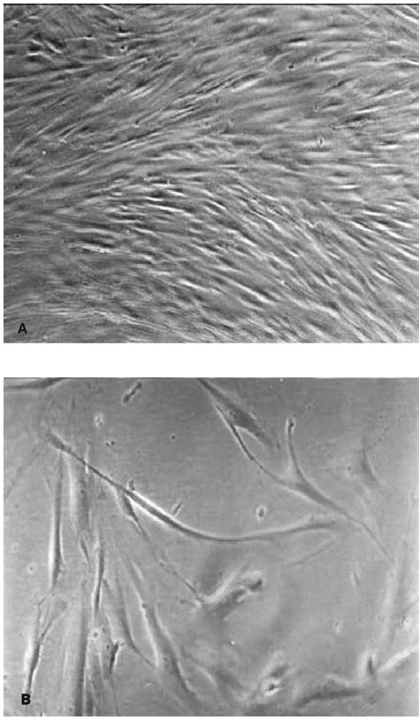 Cultures Of Human Gingival Fibroblasts From Healthy Donor A Monolayer