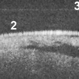 Schematic structure of an egg. 1: latebra, 2: yolk, 3: germinal disc ...