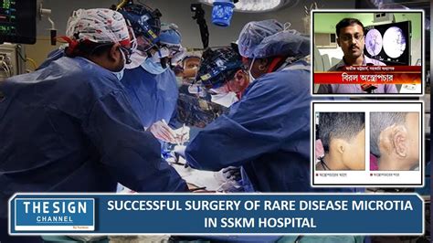 Successful Surgery Of Rare Disease Microtia In SSKM Hospital YouTube