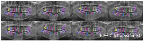 Papk Net ：基于牙齿位置先验的牙齿分割标号算法 知乎
