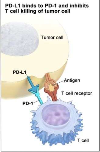 Oral Healthcare And The New Cancer Therapy Flashcards Quizlet