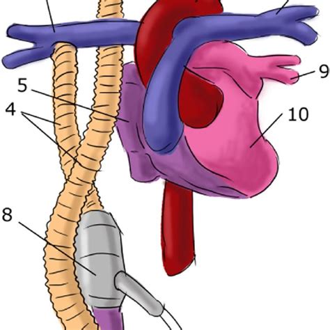 Pdf Mathematical Modeling Of The Fontan Blood Circulation Supported