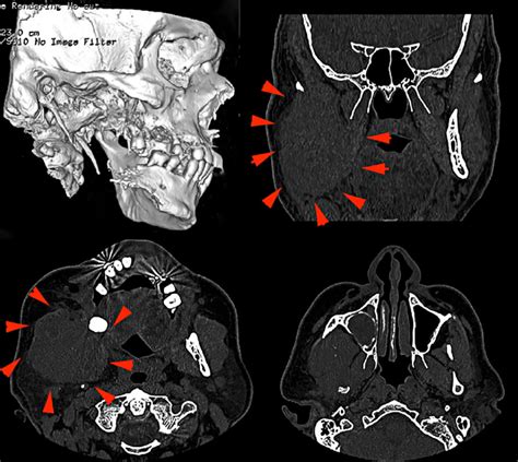 Multi Slice Computed Tomography A Dimensional Reconstruction Image