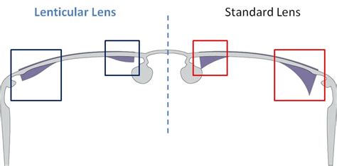 Lens Thinning