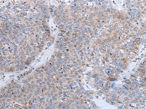 Enpp Anti Enpp Rabbit Polyclonal Antibody