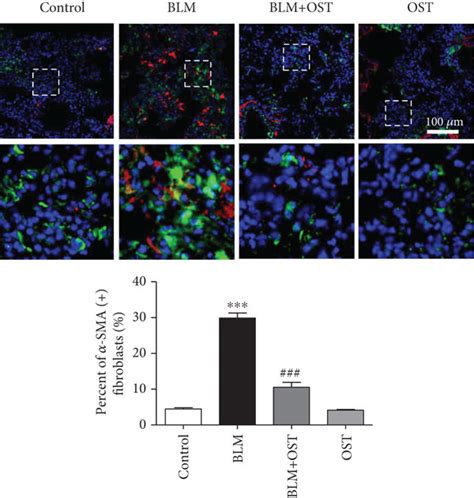 OST Attenuates BLM Induced Lung Fibroblast Differentiation In Vivo A