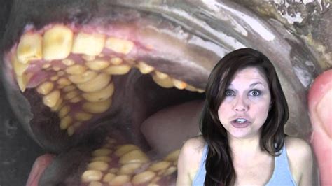 Fish With Human Teeth And MORE Best Of The Blogs 3 YouTube