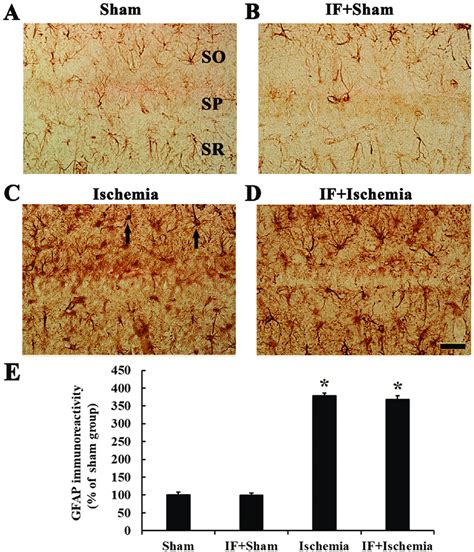 Gfap Immunohistochemistry A D Immunoreactivities Of Gfap In The Ca