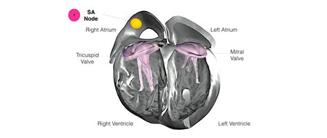 Pacemaker Implantation One Heart Cardiology