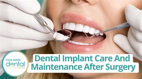 Dental Implant Aftercare And Maintenance Expert Guide