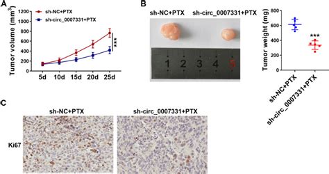 Circ 0 007 331 Promotes The PTX Resistance And Progression Of Breast