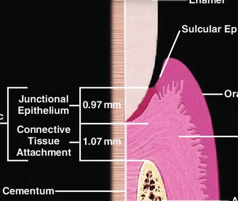 What is biological width in dentistry? | News | Dentagama