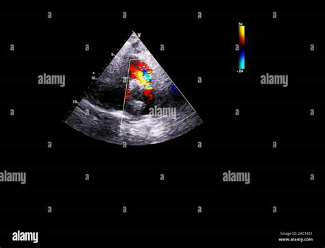 Screen of an ultrasound machine with a heart image Stock Photo - Alamy