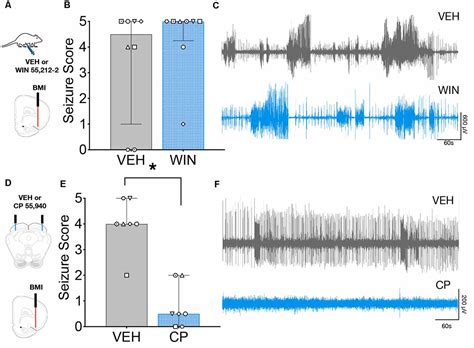 Frontiers Divergent Effects Of Systemic And Intracollicular Cb