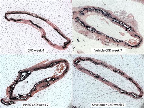 Von Kossa Stained Aortic Sections Of Untreated Ckd Rats Killed At Week Download Scientific