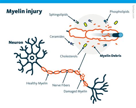 Lipid Metabolism Impacts Remyelination Lipotype Gmbh