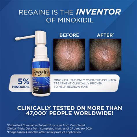 Regaine Extra Strength Minoxidil Topical Solution 5 W V Solution Stop