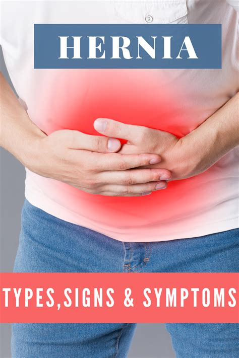 Hernia types signs and symptoms – Artofit