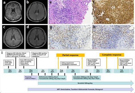 The Radiological Pathologic Diagnosis And Treatment Of Case Brain