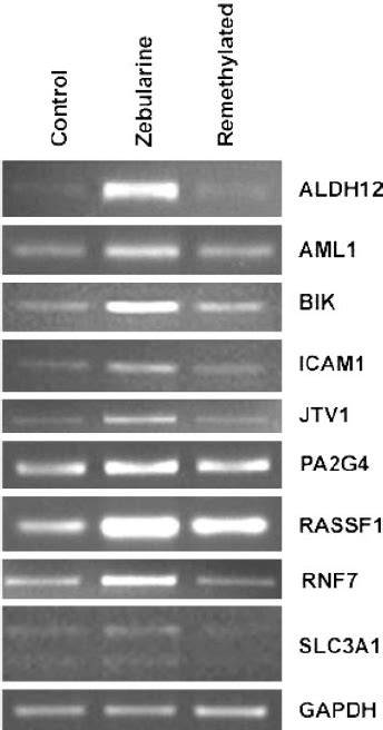 Semiquantitative Reverse Transcription Pcr For Microarray Genes