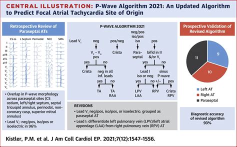 P Wave Morphology In Focal Atrial Tachycardia An Updated Algorithm To