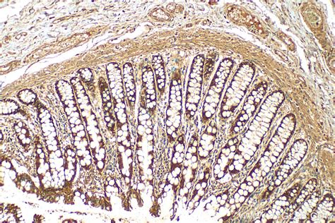 Bcl L Antibody Ap Proteintech